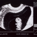 SaraRose/2007/01/ultrasounds/Images/