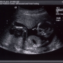 SaraRose/2007/01/ultrasounds/Images/