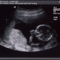 SaraRose/2007/01/ultrasounds/Images/