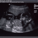 SaraRose/2007/01/ultrasounds/Images/