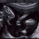 SaraRose/2007/01/ultrasounds/Images/