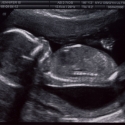 SaraRose/2007/01/ultrasounds/Images/