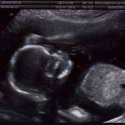 SaraRose/2007/01/ultrasounds/Images/