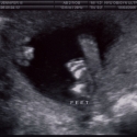 SaraRose/2007/01/ultrasounds/Images/