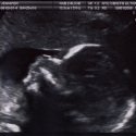 SaraRose/2007/01/ultrasounds/Images/