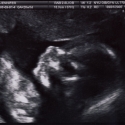 SaraRose/2007/01/ultrasounds/Images/