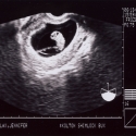 SaraRose/2007/01/ultrasounds/Images/