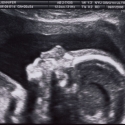 SaraRose/2007/01/ultrasounds/Images/