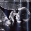 SaraRose/2007/01/ultrasounds/Images/