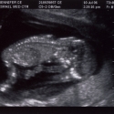 SaraRose/2007/01/ultrasounds/Images/