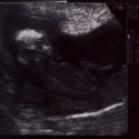 SaraRose/2007/01/ultrasounds/Images/