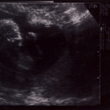 SaraRose/2007/01/ultrasounds/Images/