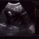 SaraRose/2007/01/ultrasounds/Images/