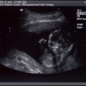 SaraRose/2007/01/ultrasounds/Images/