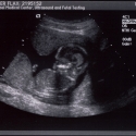 SaraRose/2007/01/ultrasounds/Images/